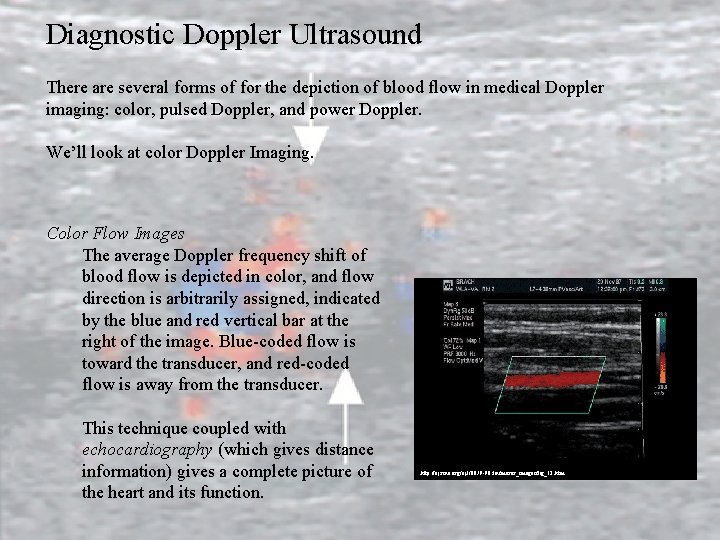 Diagnostic Doppler Ultrasound There are several forms of for the depiction of blood flow