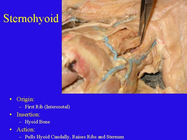 Sternohyoid • Origin: – First Rib (Intercostal) • Insertion: – Hyoid Bone • Action: