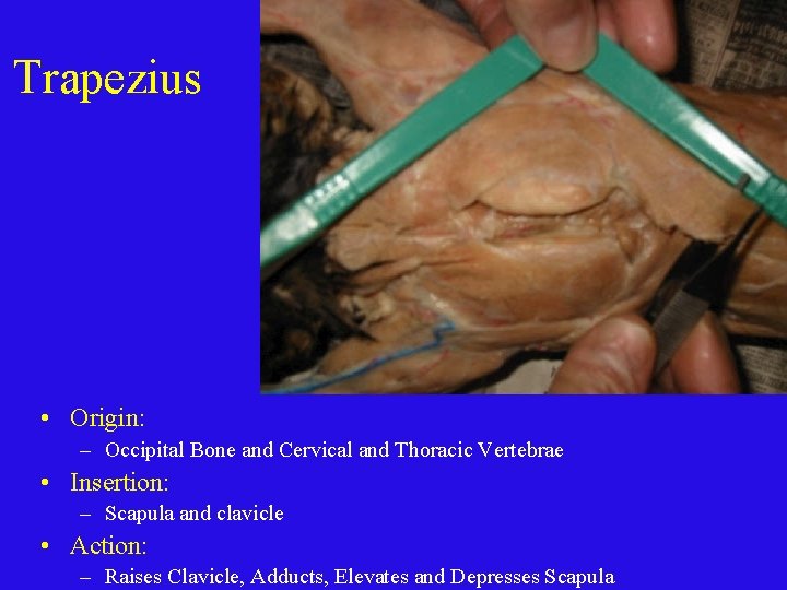 Trapezius • Origin: – Occipital Bone and Cervical and Thoracic Vertebrae • Insertion: –