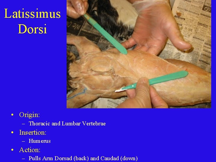 Latissimus Dorsi • Origin: – Thoracic and Lumbar Vertebrae • Insertion: – Humerus •