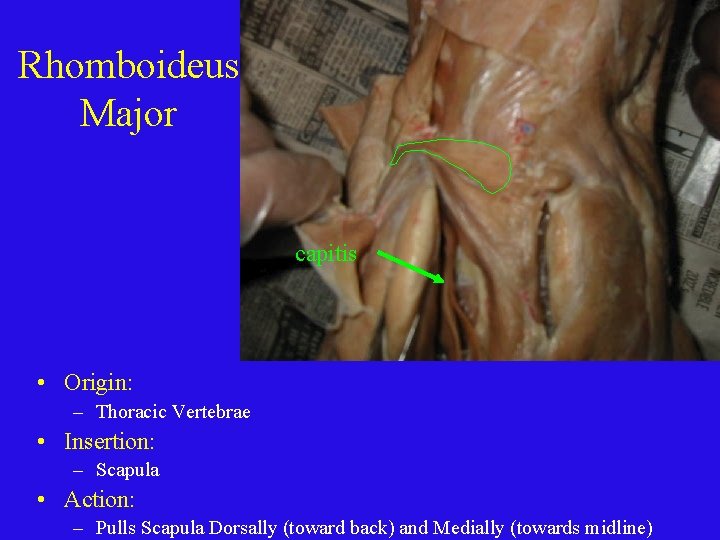Rhomboideus Major capitis • Origin: – Thoracic Vertebrae • Insertion: – Scapula • Action: