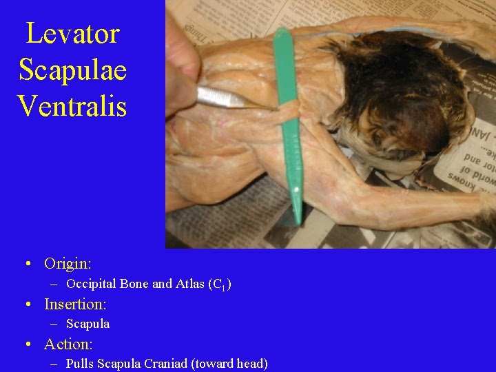 Levator Scapulae Ventralis • Origin: – Occipital Bone and Atlas (C 1) • Insertion:
