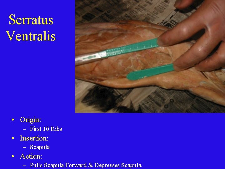 Serratus Ventralis • Origin: – First 10 Ribs • Insertion: – Scapula • Action: