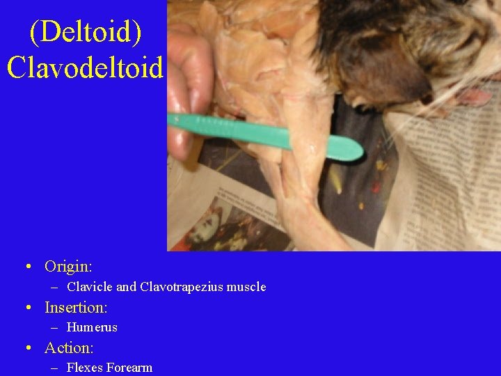 (Deltoid) Clavodeltoid • Origin: – Clavicle and Clavotrapezius muscle • Insertion: – Humerus •