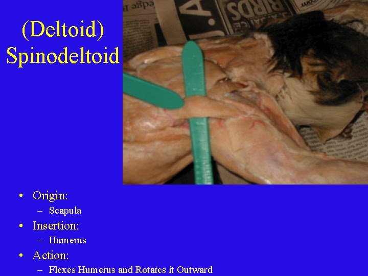 (Deltoid) Spinodeltoid • Origin: – Scapula • Insertion: – Humerus • Action: – Flexes
