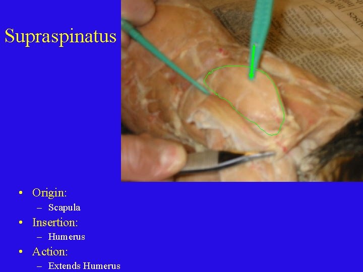 Supraspinatus • Origin: – Scapula • Insertion: – Humerus • Action: – Extends Humerus