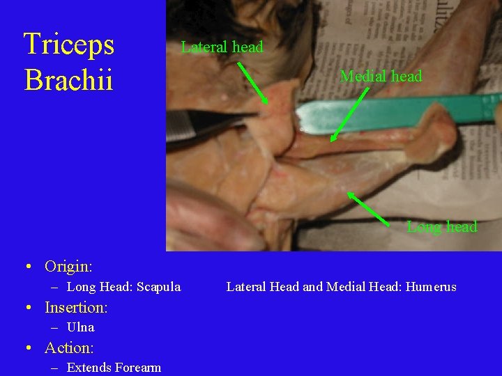 Triceps Brachii Lateral head Medial head Long head • Origin: – Long Head: Scapula