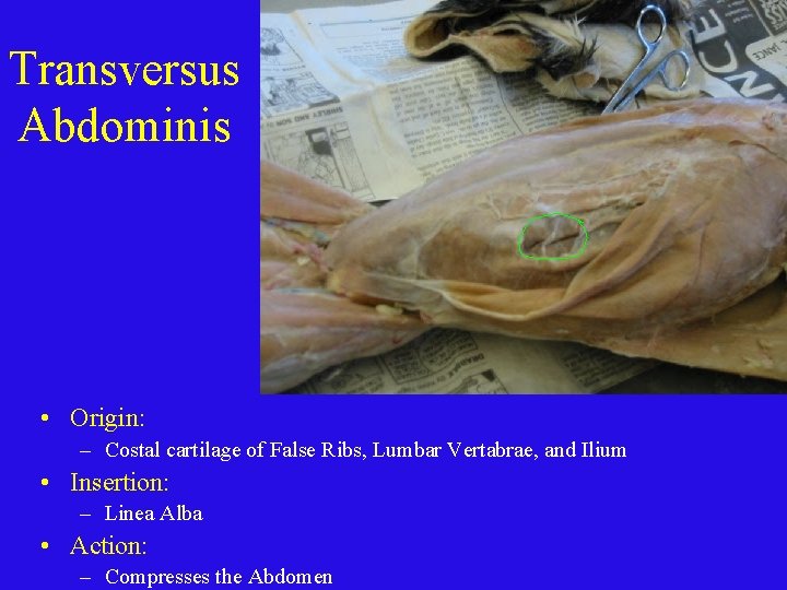 Transversus Abdominis • Origin: – Costal cartilage of False Ribs, Lumbar Vertabrae, and Ilium