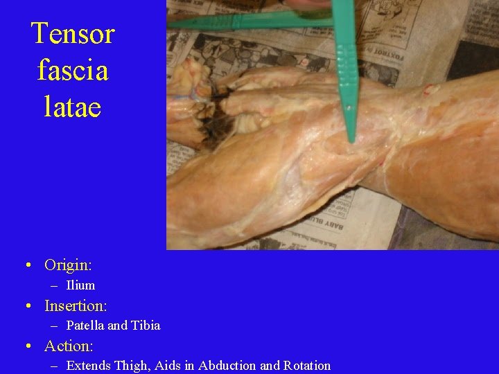 Tensor fascia latae • Origin: – Ilium • Insertion: – Patella and Tibia •