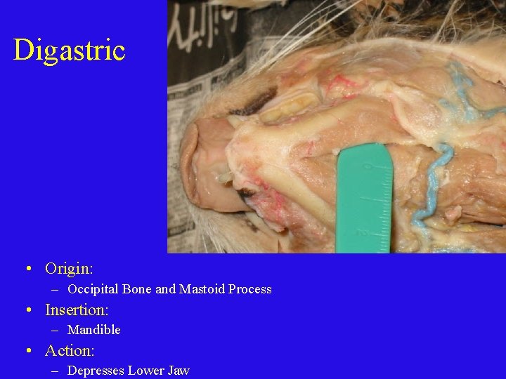 Digastric • Origin: – Occipital Bone and Mastoid Process • Insertion: – Mandible •