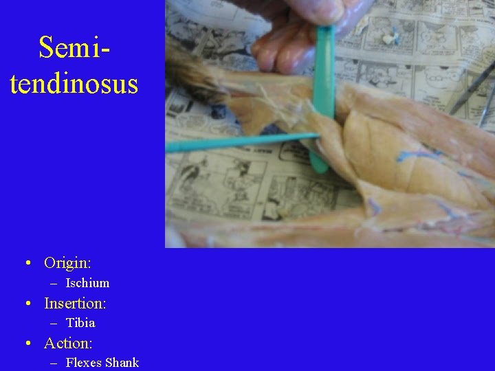 Semitendinosus • Origin: – Ischium • Insertion: – Tibia • Action: – Flexes Shank