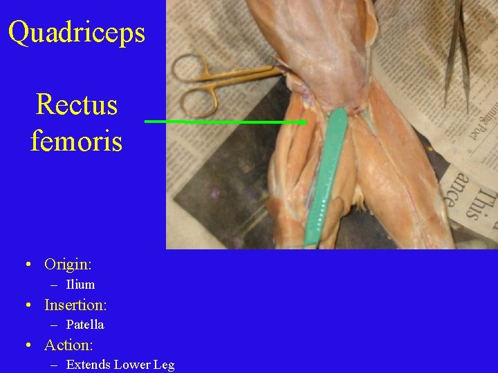 Quadriceps Rectus femoris • Origin: – Ilium • Insertion: – Patella • Action: –
