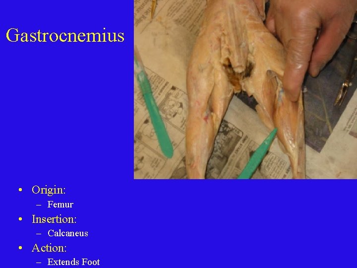 Gastrocnemius • Origin: – Femur • Insertion: – Calcaneus • Action: – Extends Foot