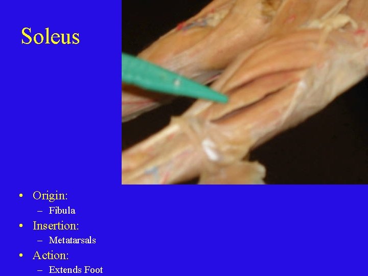 Soleus • Origin: – Fibula • Insertion: – Metatarsals • Action: – Extends Foot