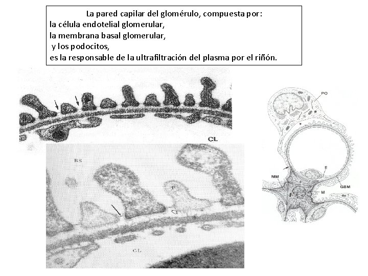 La pared capilar del glomérulo, compuesta por: la célula endotelial glomerular, la membrana basal