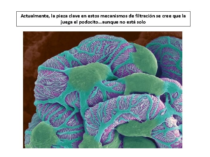 Actualmente, la pieza clave en estos mecanismos de filtración se cree que la juega