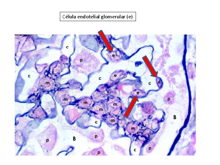 Célula endotelial glomerular (e) 