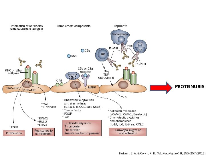 PROTEINURIA 