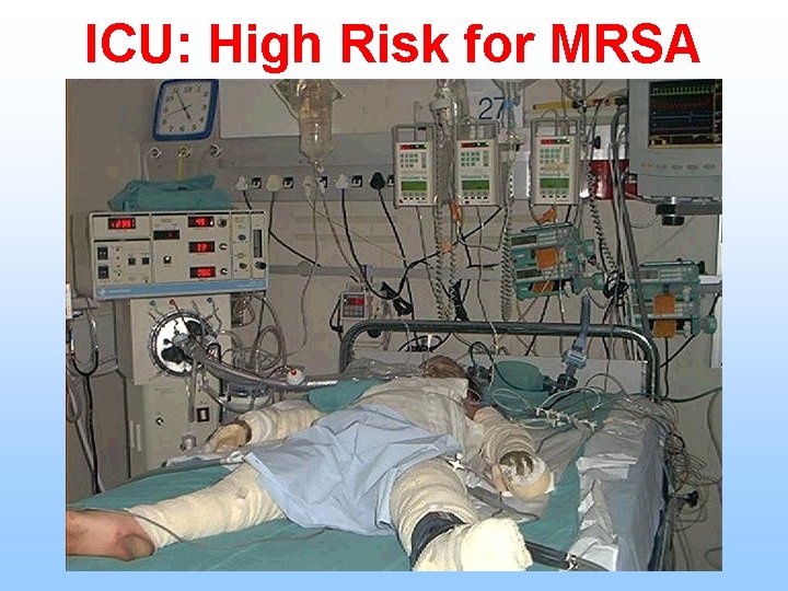 ICU: High Risk for MRSA 29 
