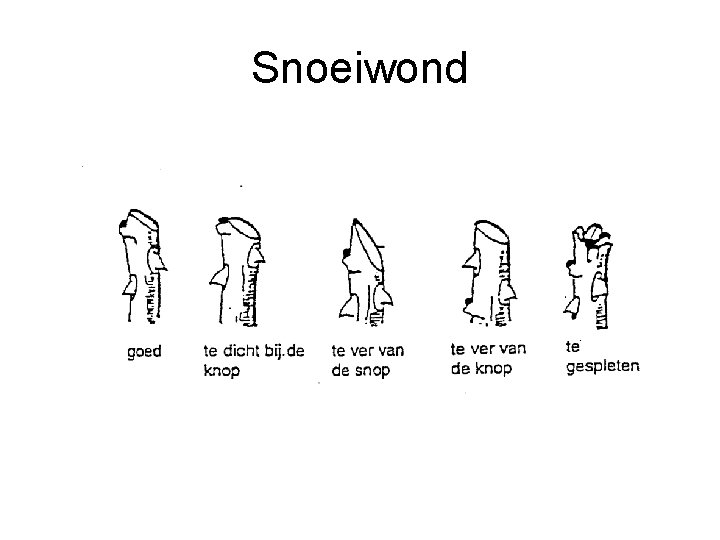 Snoeiwond 