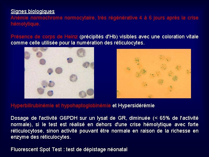 Signes biologiques Anémie normochrome normocytaire, très régénérative 4 à 6 jours après la crise