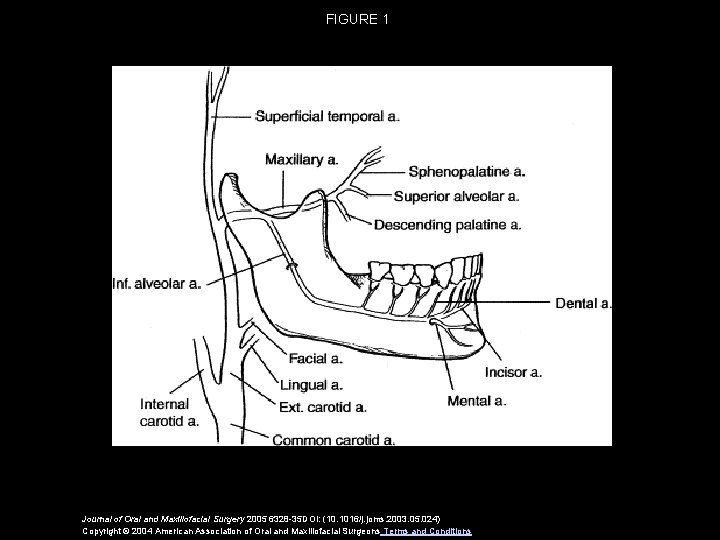 FIGURE 1 Journal of Oral and Maxillofacial Surgery 2005 6328 -35 DOI: (10. 1016/j.