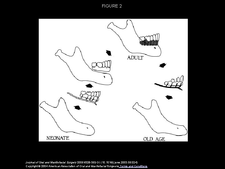 FIGURE 2 Journal of Oral and Maxillofacial Surgery 2005 6328 -35 DOI: (10. 1016/j.