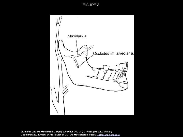 FIGURE 3 Journal of Oral and Maxillofacial Surgery 2005 6328 -35 DOI: (10. 1016/j.