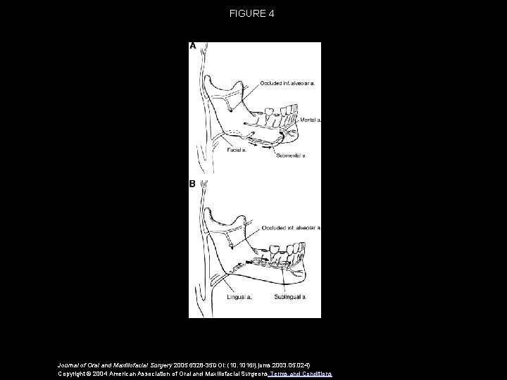 FIGURE 4 Journal of Oral and Maxillofacial Surgery 2005 6328 -35 DOI: (10. 1016/j.