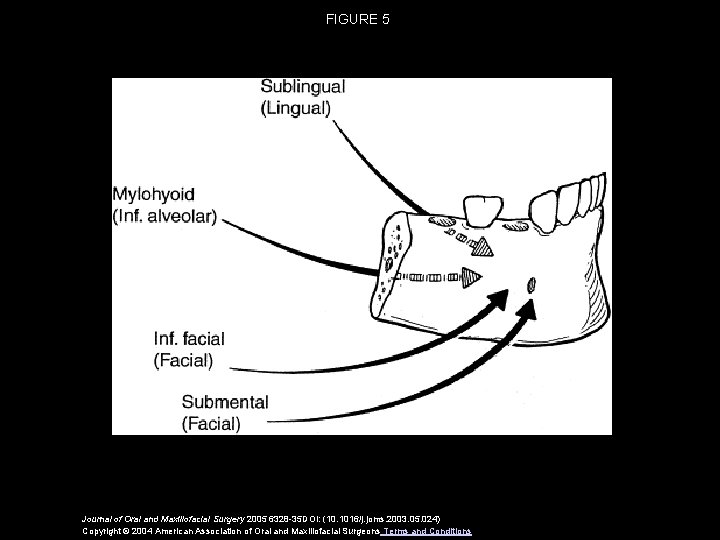 FIGURE 5 Journal of Oral and Maxillofacial Surgery 2005 6328 -35 DOI: (10. 1016/j.