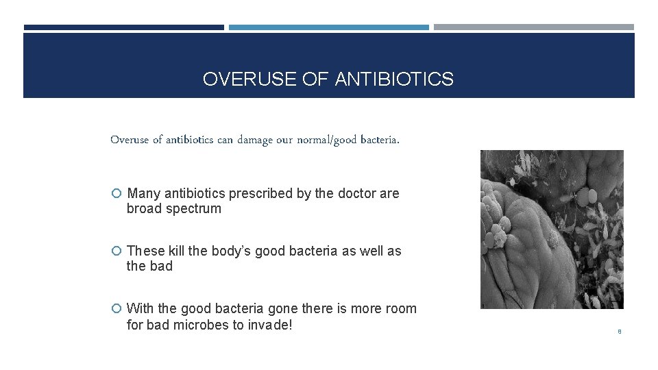 OVERUSE OF ANTIBIOTICS Overuse of antibiotics can damage our normal/good bacteria. Many antibiotics prescribed