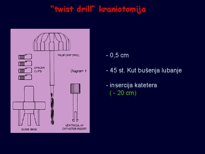 “twist drill” kraniotomija - 0, 5 cm - 45 st. Kut bušenja lubanje -