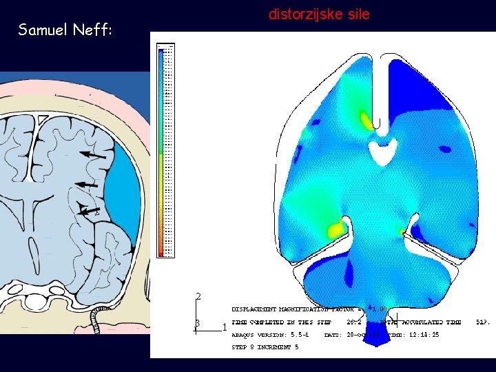 Samuel Neff: distorzijske sile 