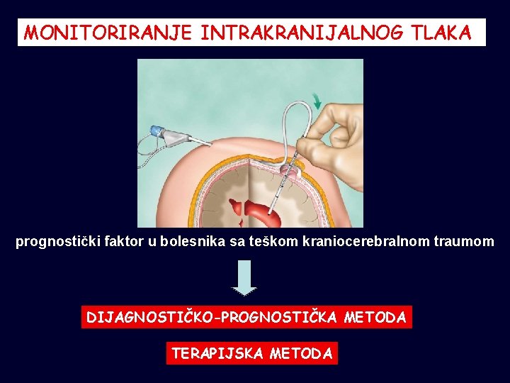 MONITORIRANJE INTRAKRANIJALNOG TLAKA prognostički faktor u bolesnika sa teškom kraniocerebralnom traumom DIJAGNOSTIČKO-PROGNOSTIČKA METODA TERAPIJSKA