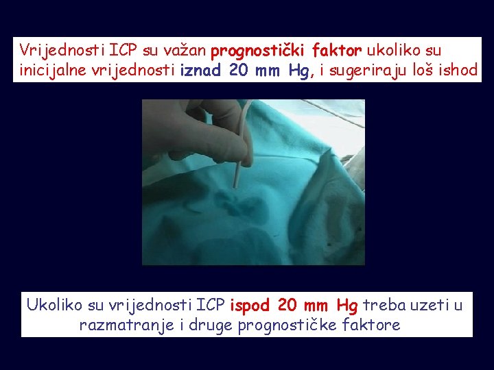 Vrijednosti ICP su važan prognostički faktor ukoliko su inicijalne vrijednosti iznad 20 mm Hg,