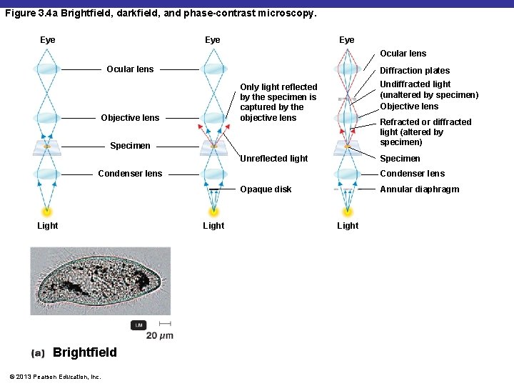 Figure 3. 4 a Brightfield, darkfield, and phase-contrast microscopy. Eye Eye Ocular lens Diffraction