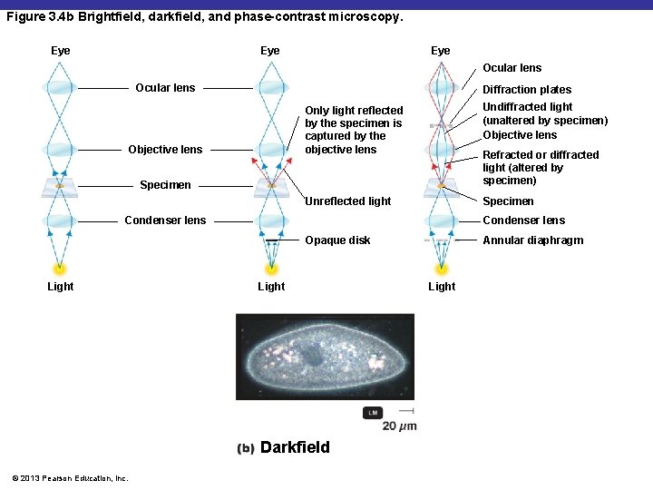 Figure 3. 4 b Brightfield, darkfield, and phase-contrast microscopy. Eye Eye Ocular lens Diffraction