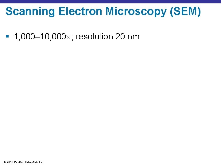 Scanning Electron Microscopy (SEM) § 1, 000– 10, 000 ; resolution 20 nm ©