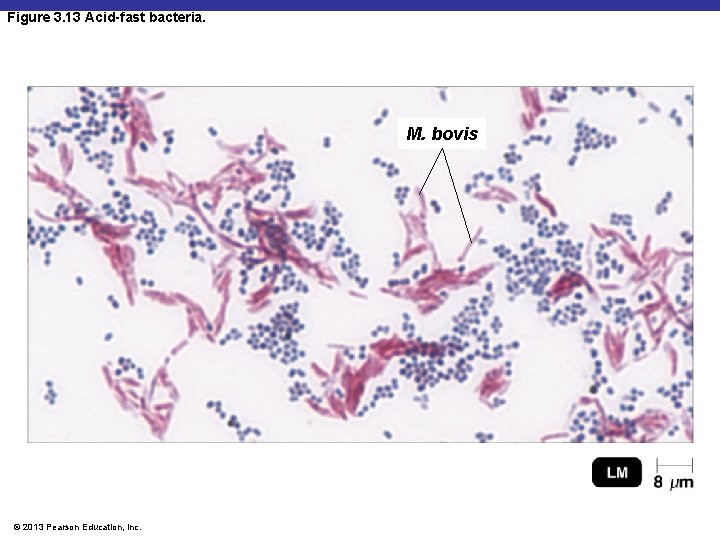 Figure 3. 13 Acid-fast bacteria. M. bovis © 2013 Pearson Education, Inc. 