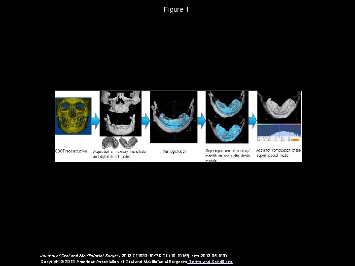 Figure 1 Journal of Oral and Maxillofacial Surgery 2013 711933 -1947 DOI: (10. 1016/j.