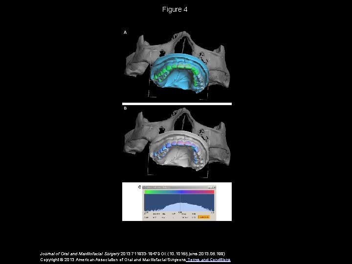 Figure 4 Journal of Oral and Maxillofacial Surgery 2013 711933 -1947 DOI: (10. 1016/j.