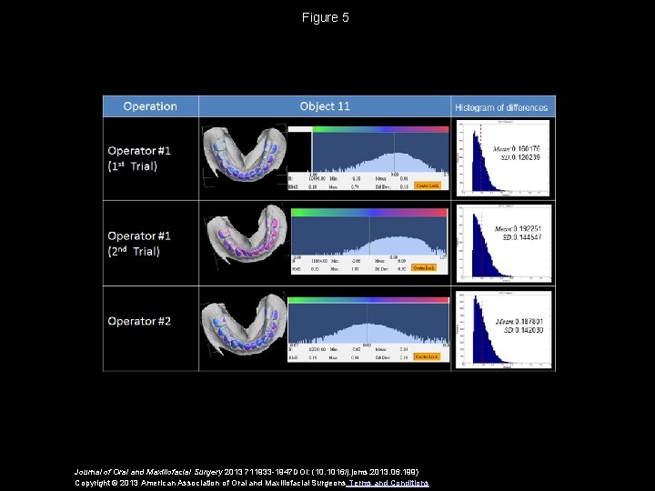 Figure 5 Journal of Oral and Maxillofacial Surgery 2013 711933 -1947 DOI: (10. 1016/j.