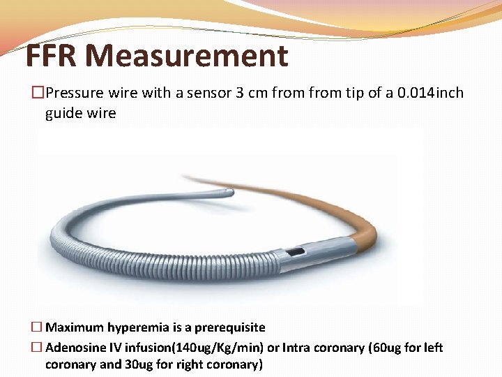 FFR Measurement �Pressure with a sensor 3 cm from tip of a 0. 014 FFR Measurement �Pressure with a sensor 3 cm from tip of a 0. 014