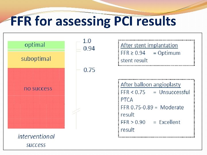 FFR for assessing PCI results �Eg: PCI for RCA serial stenosis FFR for assessing PCI results �Eg: PCI for RCA serial stenosis