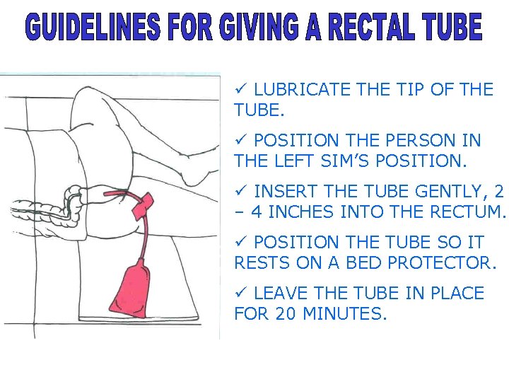 ü LUBRICATE THE TIP OF THE TUBE. ü POSITION THE PERSON IN THE LEFT