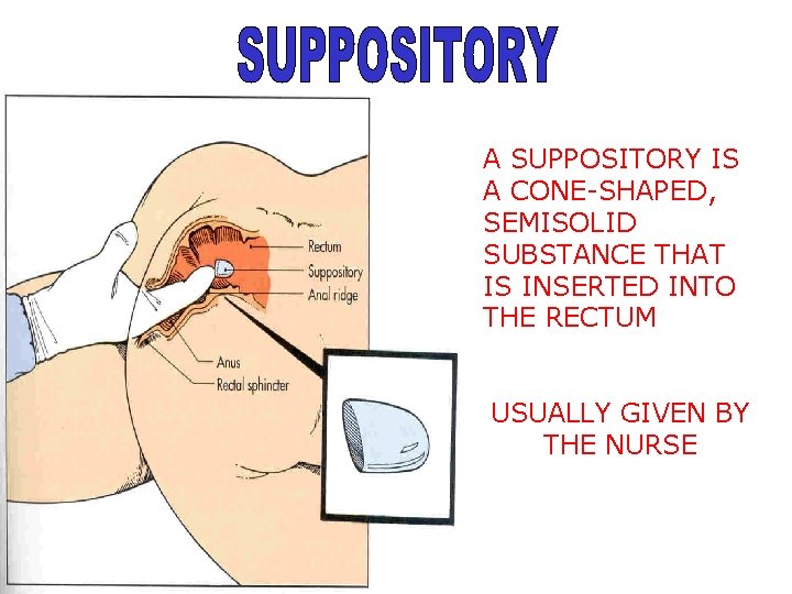 A SUPPOSITORY IS A CONE-SHAPED, SEMISOLID SUBSTANCE THAT IS INSERTED INTO THE RECTUM USUALLY