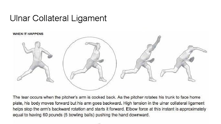 Ulnar Collateral Ligament 