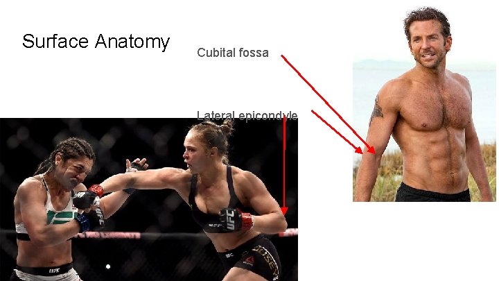 Surface Anatomy Cubital fossa Lateral epicondyle 