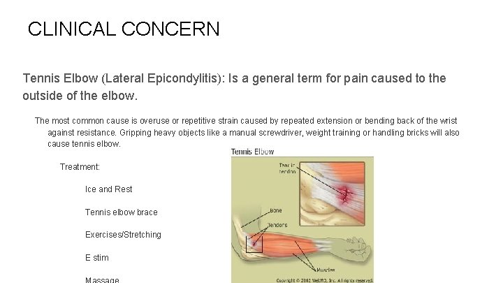 CLINICAL CONCERN Tennis Elbow (Lateral Epicondylitis): Is a general term for pain caused to