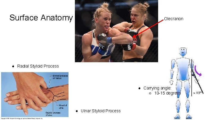 Surface Anatomy Olecranon ● Radial Styloid Process ● Carrying angle: ○ 10 -15 degrees